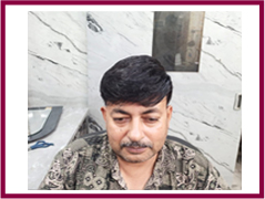 Silk base hair patch