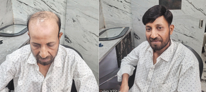 1 Hair weaving service in Howrah