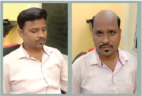 Hair weaving service in Howrah